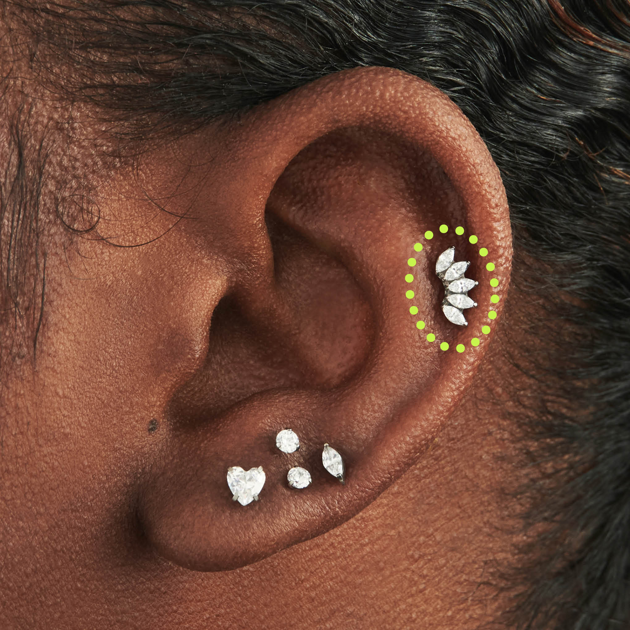 686-titanium-crown-2.jpg Titanium Crown